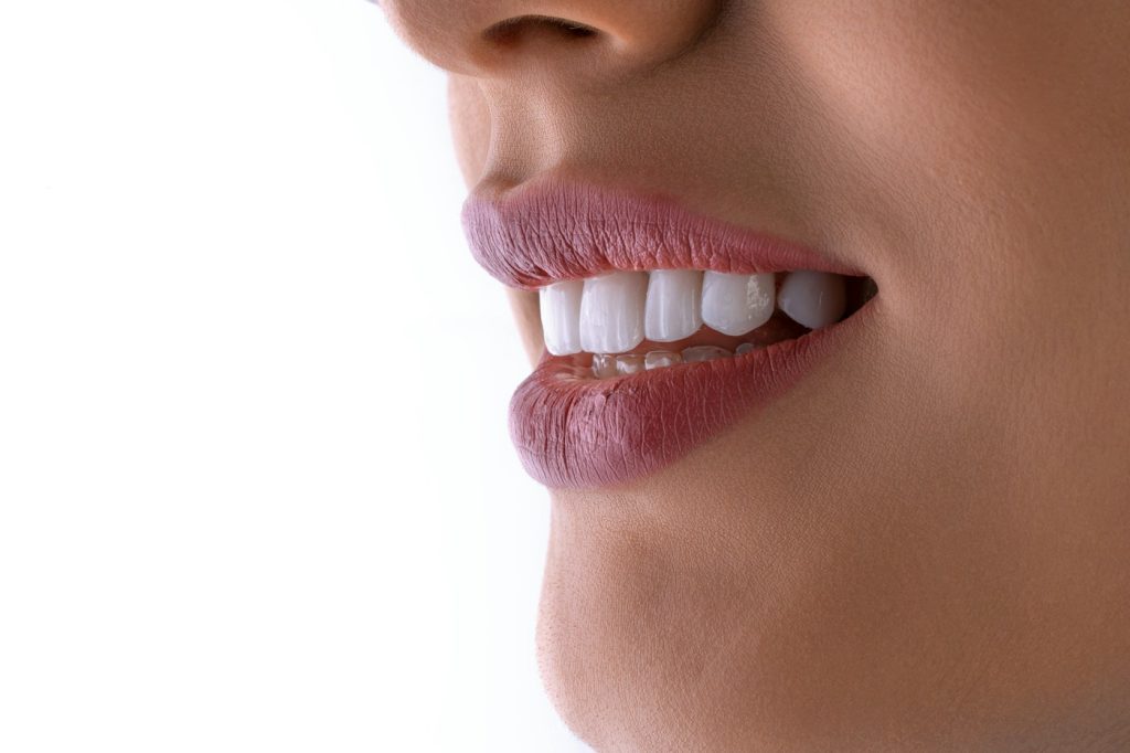 After Whitening