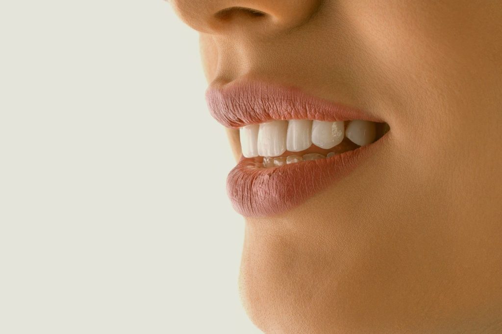 Before Whitening